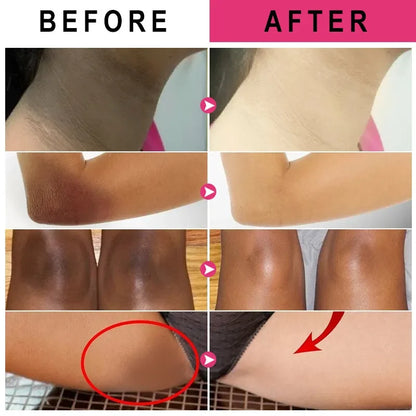 Vitamin C Brightening Cream for Dark Spots, Underarms, Elbows and Knees