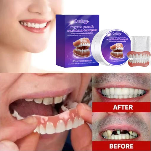 Flexible Silicone Denture Set – Natural Looking Smile Veneer for Upper and Lower Teeth - 1