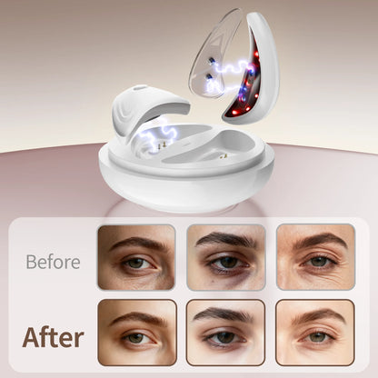 Microcurrent Red Light Under Eye Massager for Dark Circles and Puffiness