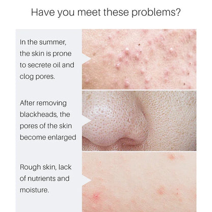 Pore Minimizing Facial Serum - Deep Pore Cleansing & Skin Tightening Treatment