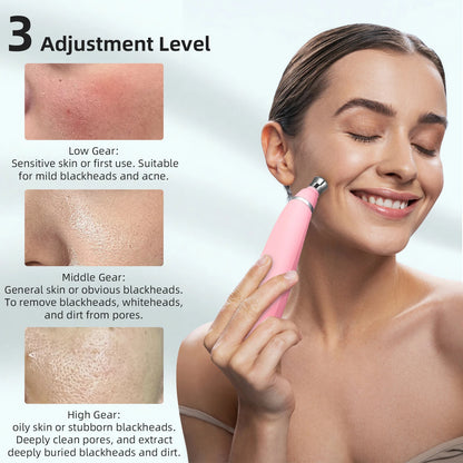 2-in-1 Microdermabrasion Facial Device & Blackhead Vacuum