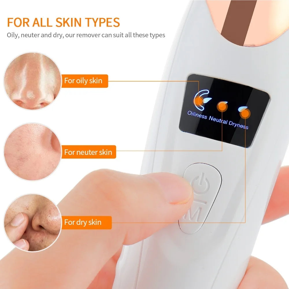 Electric Vacuum Blackhead Remover & Facial Pore Cleanser - 3