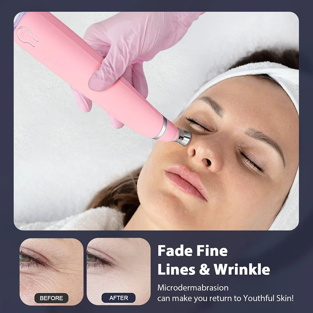 2-in-1 Microdermabrasion F...abrasion Facial Device & Blackhead Vacuum - 34
