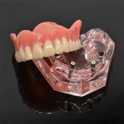 Natural Silicone Cosmetic Teeth Covers - Full Upper & Lower Denture Set