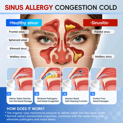 Electric Nasal Irrigation System for Sinus Relief and Nasal Congestion