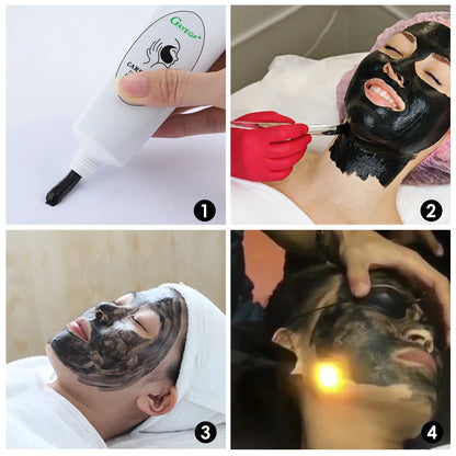 Carbon Laser Facial Gel - Deep Cleansing & Skin Rejuvenation Pore Treatment