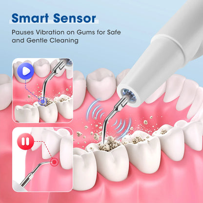 Ultrasonic Teeth Cleaner - Electric Tartar & Plaque Remover for Oral Care
