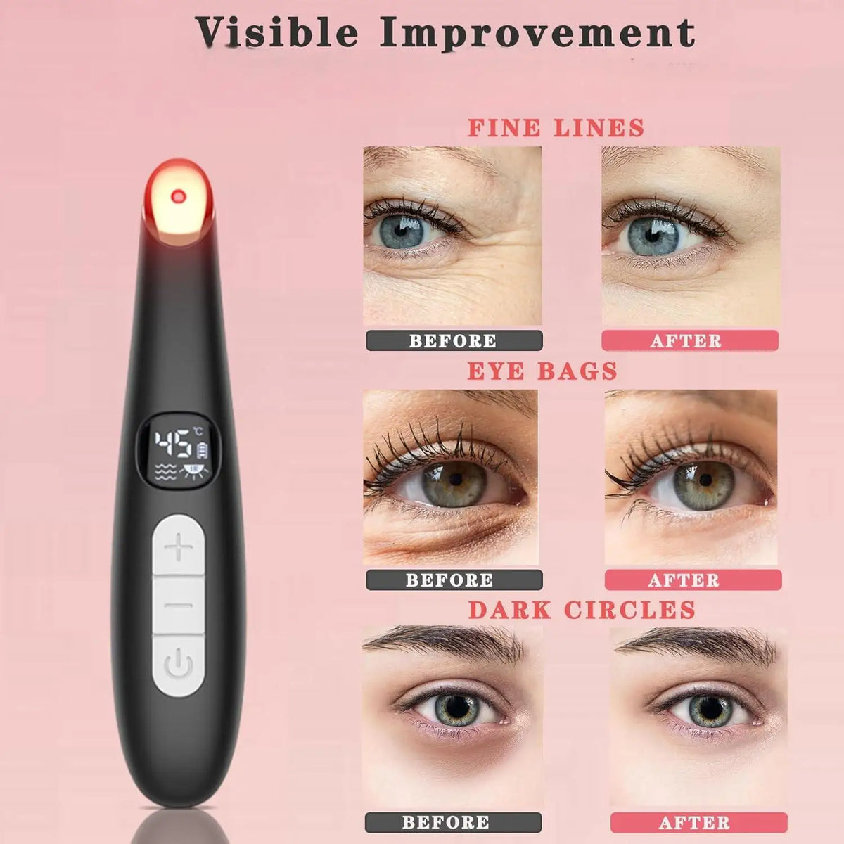 3-in-1 LED Eye Lift Wand: Heated Vibration Massager for Dark Circles & Puffiness