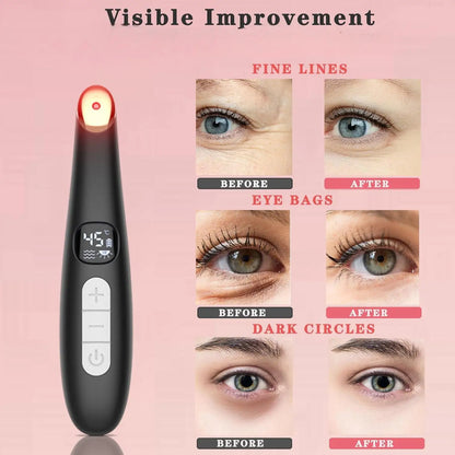 3-in-1 LED Eye Lift Wand: Heated Vibration Massager for Dark Circles & Puffiness