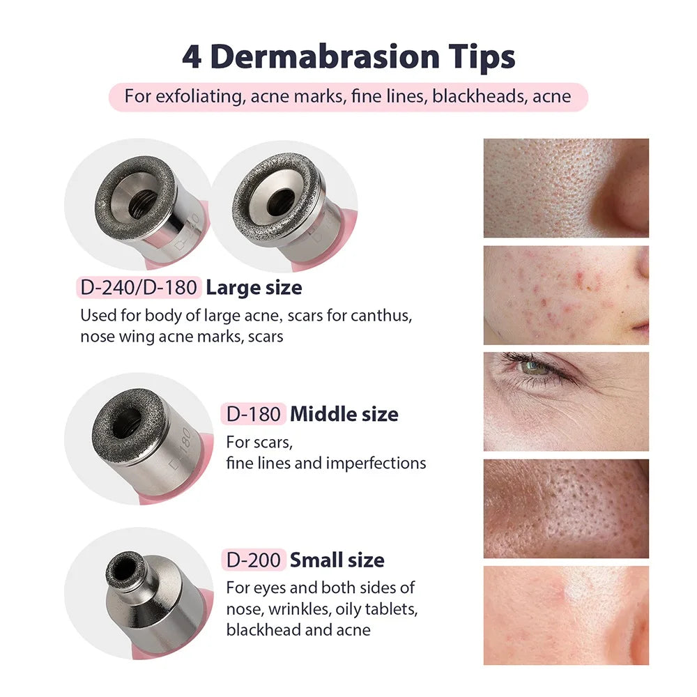 2-in-1 Microdermabrasion Facial Device & Blackhead Vacuum - 3