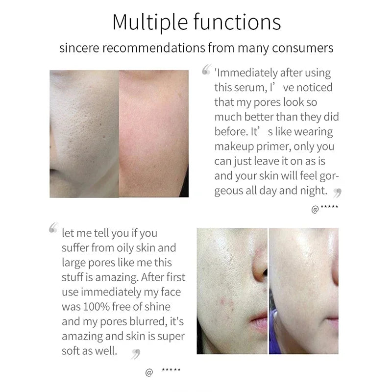 Pore Minimizing Facial Serum - Deep Pore Cleansing & Skin Tightening Treatment - 14