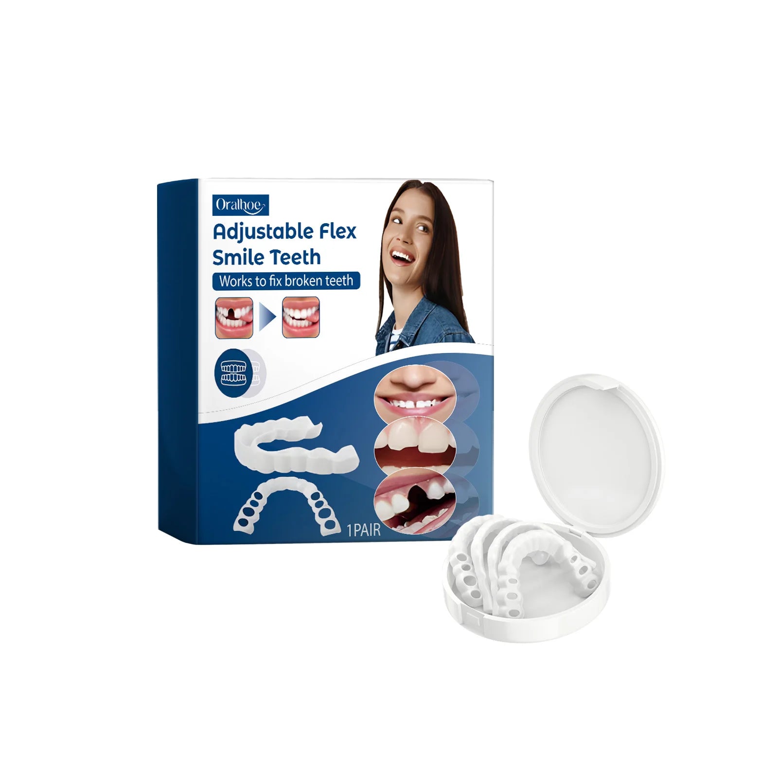 Snap-On Adjustable Smile Veneers for Instant Teeth Coverage and Whitening - 6