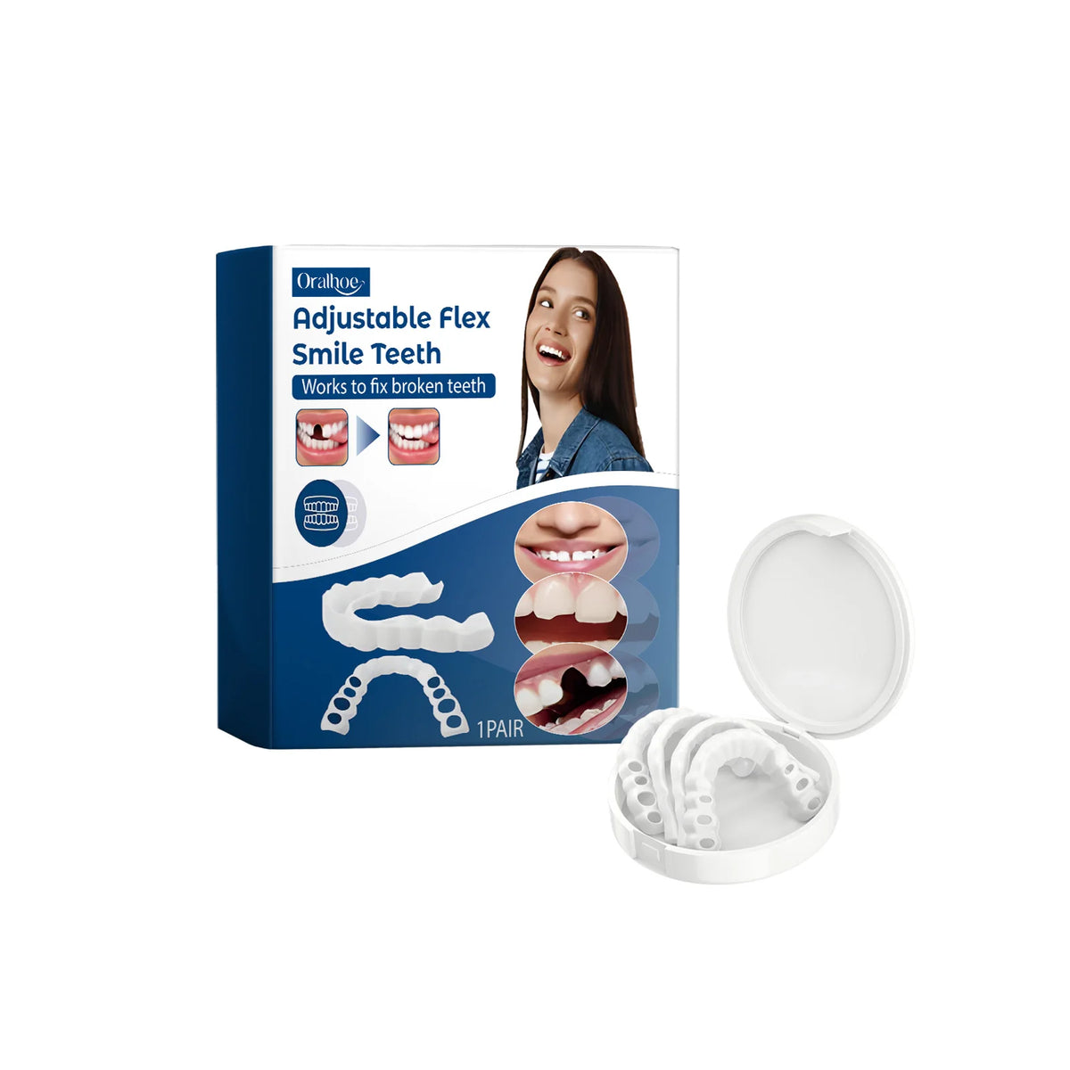 Snap-On Adjustable Smile Veneers for Instant Teeth Coverage and Whitening