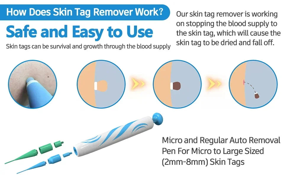 2-in-1 Skin Tag Removal Kit - Painless Home Mole & Skin Tag Remover Tool - 10