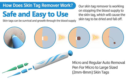 2-in-1 Skin Tag Removal Kit - Painless Home Mole & Skin Tag Remover Tool