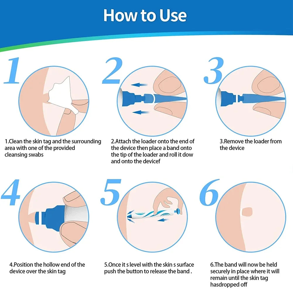 2-in-1 Skin Tag Removal Kit - Painless Home Mole & Skin Tag Remover Tool - 6