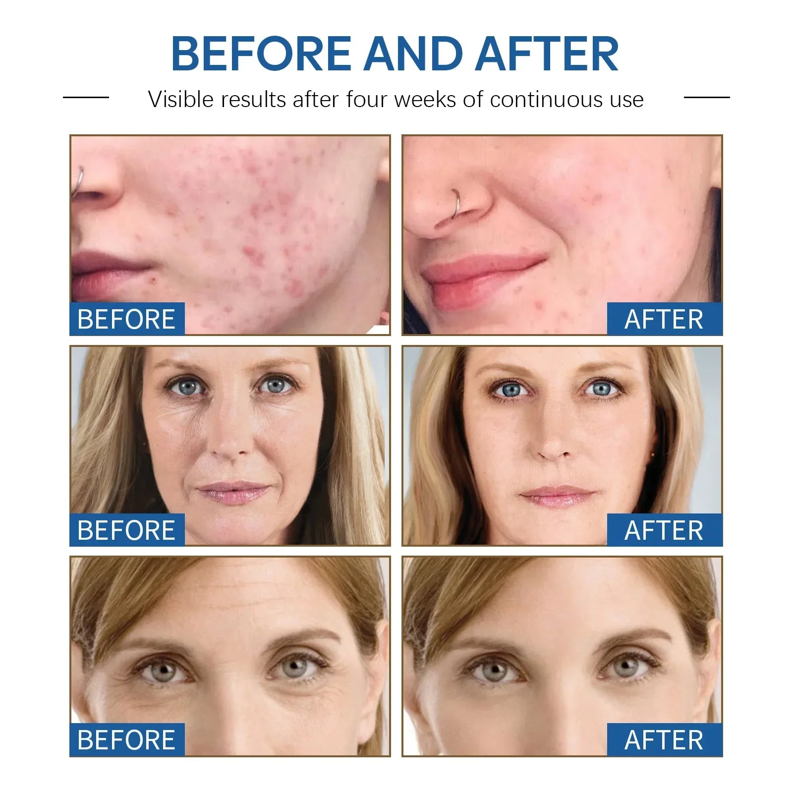Anti-Aging Face Cream for Instant Wrinkle Removal & Skin Firming - 14