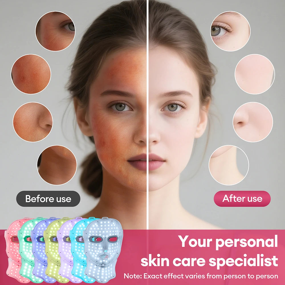 7 Color LED Face & Neck Mask - Anti-Aging Light Therapy