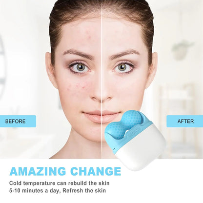 2-in-1 Facial & Body Ice Roller for Skin Tightening and Depuffing Massage