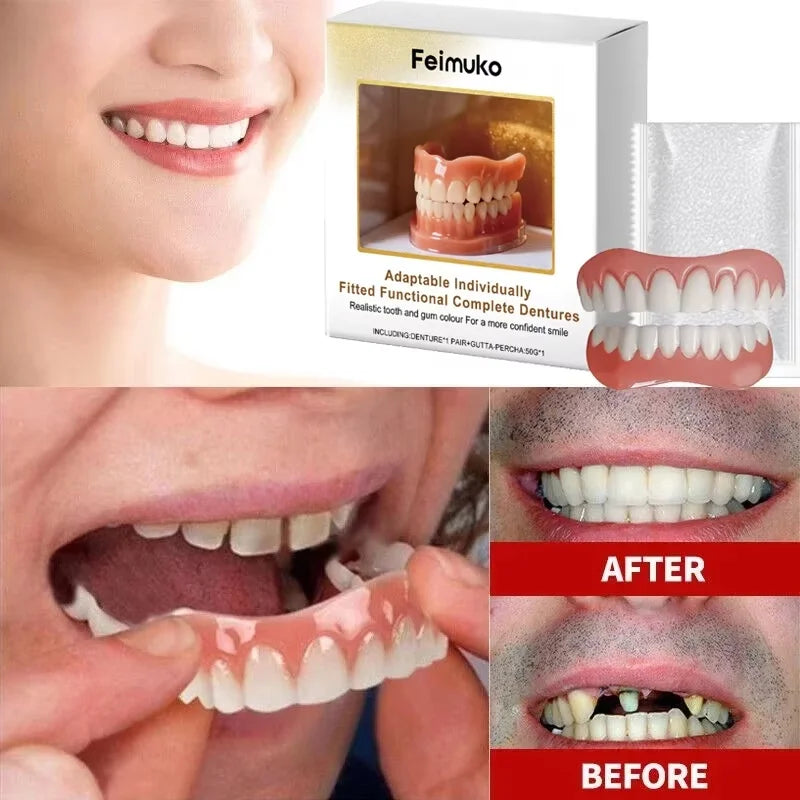 Custom-Fit Dental Veneer Set for Instant Smile Transformation - 2