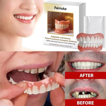 Custom-Fit Dental Veneer Set for Instant Smile Transformation