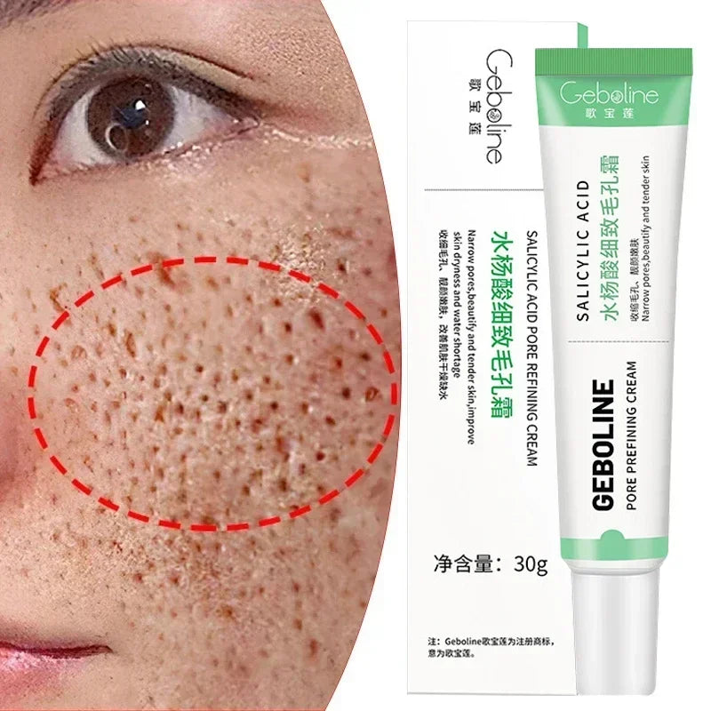 Salicylic Acid Pore Refining Cream - Acne Scar & Blackhead Treatment - 6