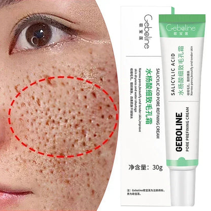 Salicylic Acid Pore Refining Cream - Acne Scar & Blackhead Treatment