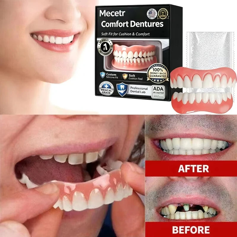 Adjustable Comfort Fit Dental Veneers - Natural Looking Smile Solution - 1