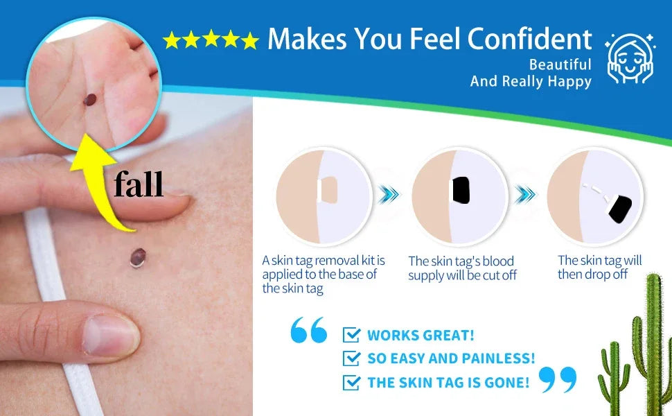 2-in-1 Skin Tag Removal Kit - Painless Home Mole & Skin Tag Remover Tool - 8