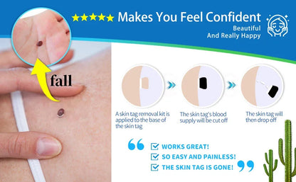 2-in-1 Skin Tag Removal Kit - Painless Home Mole & Skin Tag Remover Tool