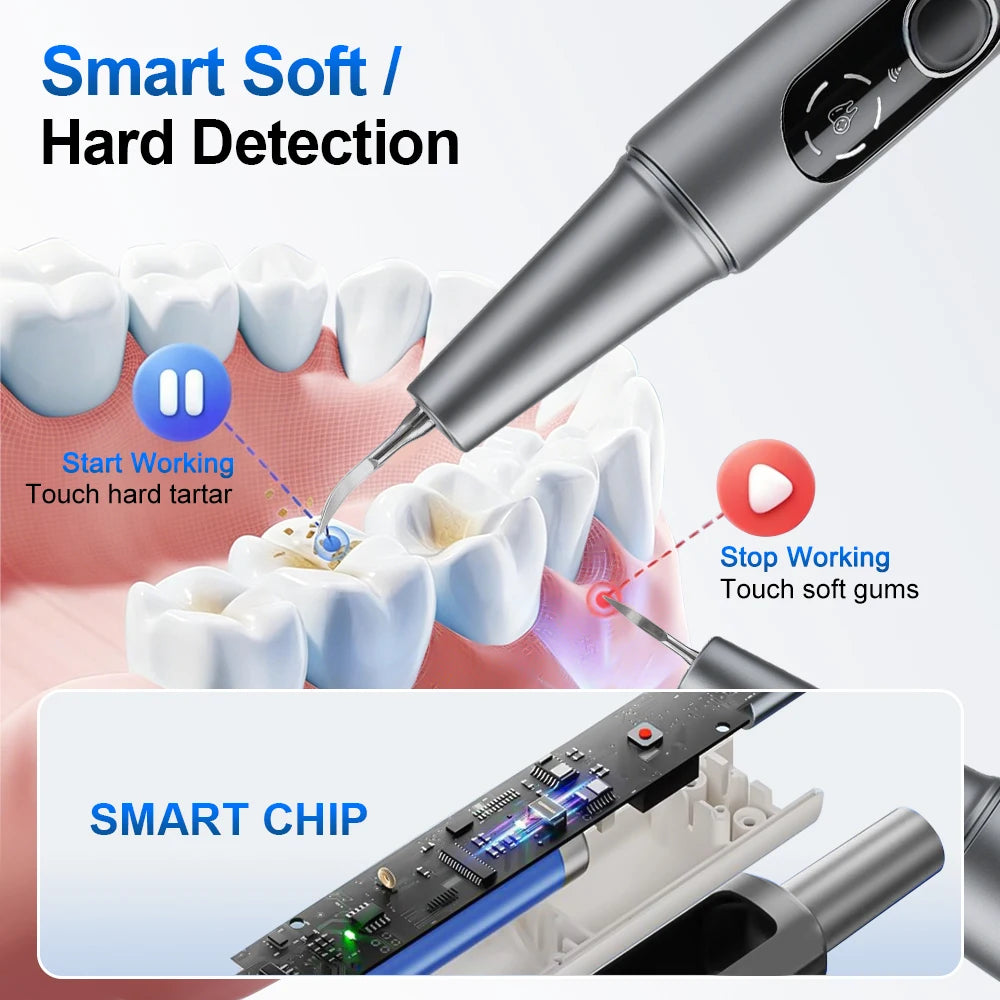 Visual Ultrasonic Tooth Cleaner with HD Camera & LED Light