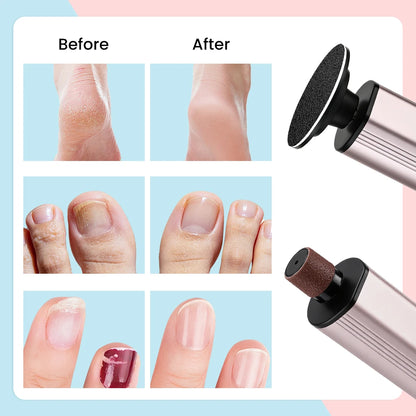 Electric Foot Callus Remover & Nail Polishing Kit – Professional Rechargeable Tool