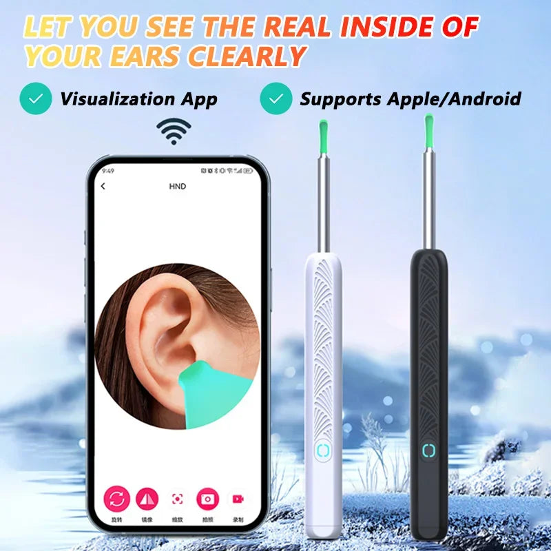Smart Visual Ear Wax Remover - 1080P HD Camera Otoscope Cleaner