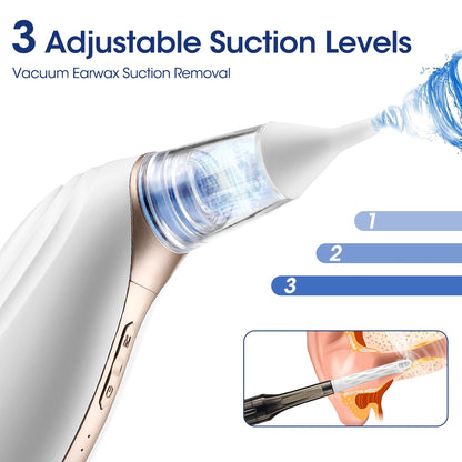 Intelligent Electric Earwax Removal Vacuum Cleaner with Adjustable Suction