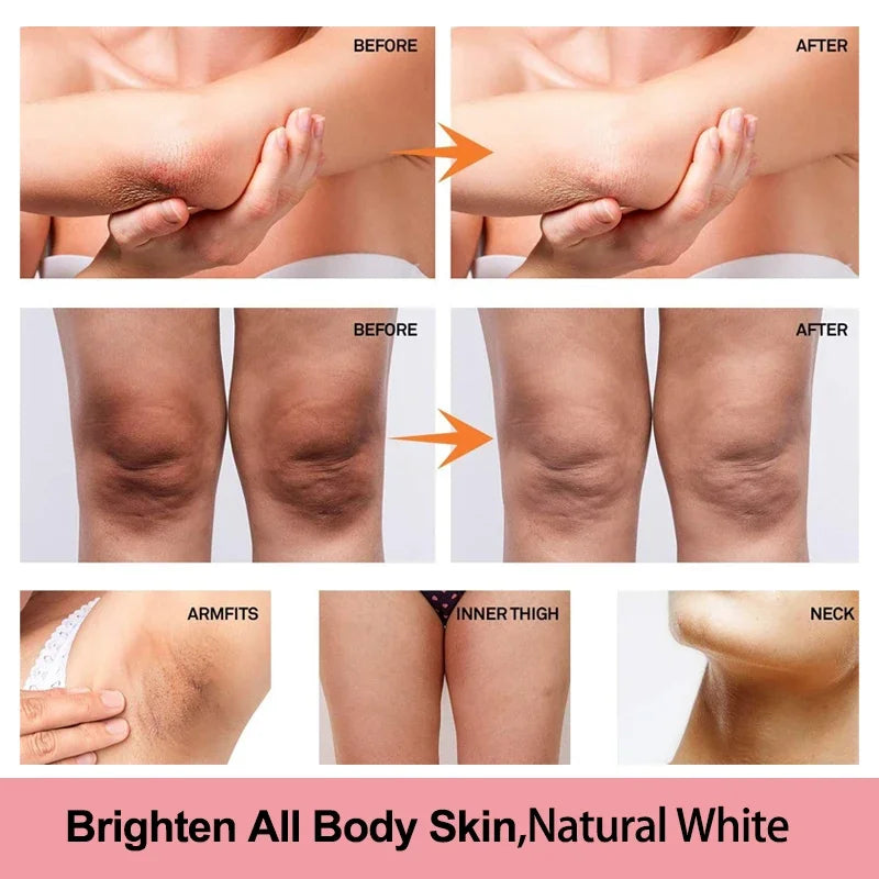 Vitamin C Brightening Cream for Dark Spots, Underarms, Elbows and Knees