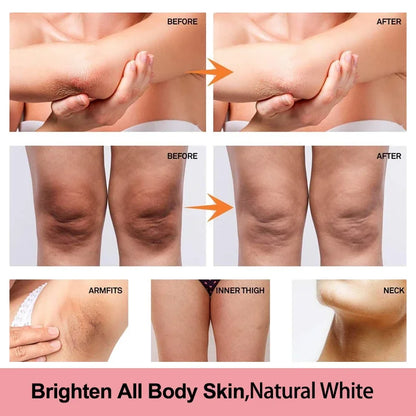 Vitamin C Brightening Cream for Dark Spots, Underarms, Elbows and Knees