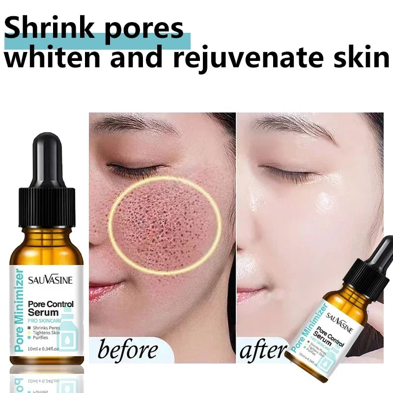 Pore Minimizing Facial Serum - Deep Pore Cleansing & Skin Tightening Treatment