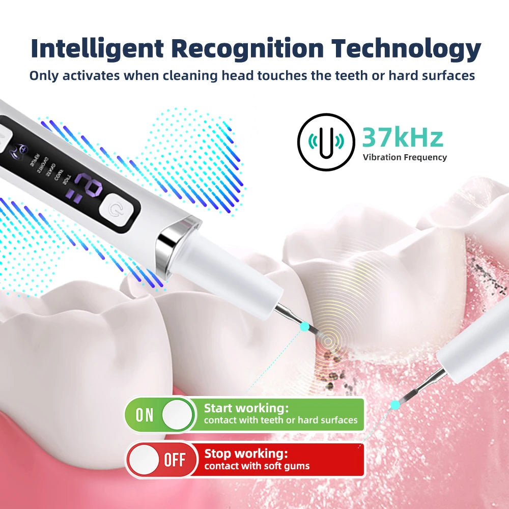 Ultrasonic Electric Teeth Cleaner & Tartar Remover for Professional Oral Care - 12
