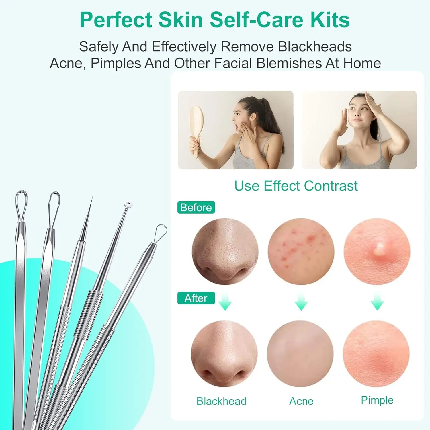 Professional Stainless Steel Blackhead Extractor & Pimple Popper Tool Kit - 4