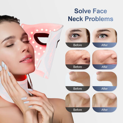 Wireless 7-Color LED Light Therapy Silicone Face & Neck Mask