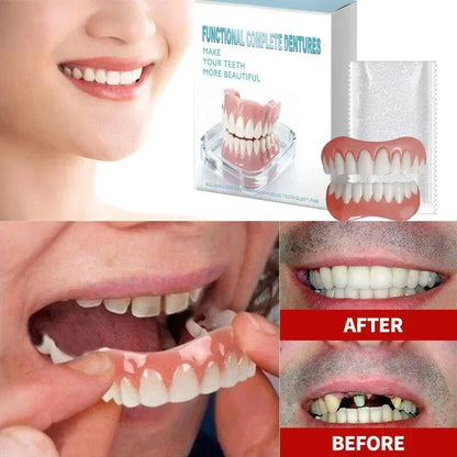 Instant Smile Cosmetic Dentures - Natural Looking Upper & Lower Teeth Veneers