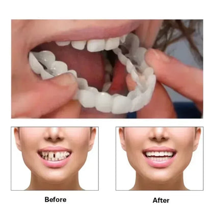 Comfort Fit Silicone Denture Set for Instant Smile Transformation