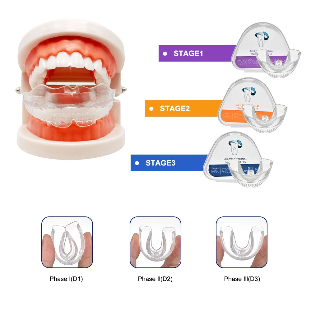 3-Stage Dental Teeth Trainer & Orthodontic Alignment Braces for Adults - 1