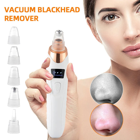 Electric Vacuum Blackhead Remover & Facial Pore Cleanser