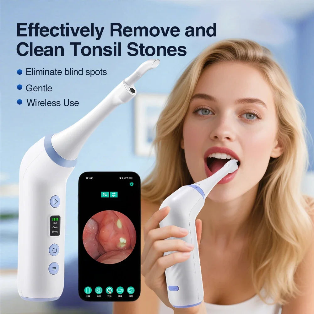 Visible Tonsil Stone Remover Kit with HD Camera & Vacuum Suction - 1