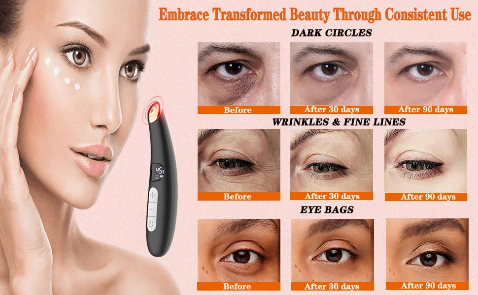 3-in-1 LED Eye Lift Wand: Heated Vibration Massager for Dark Circles & Puffiness