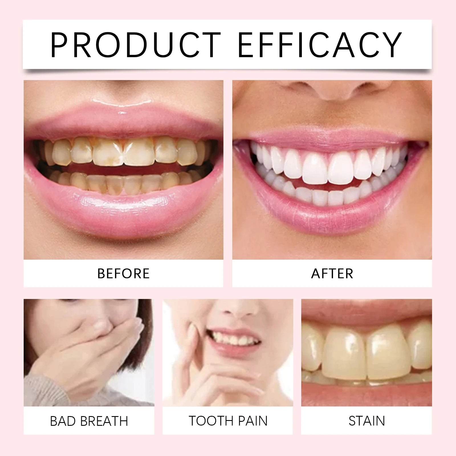 Nicotinamide Teeth Whitening Toothpaste - Deep Stain Removal & Gum Care - 17