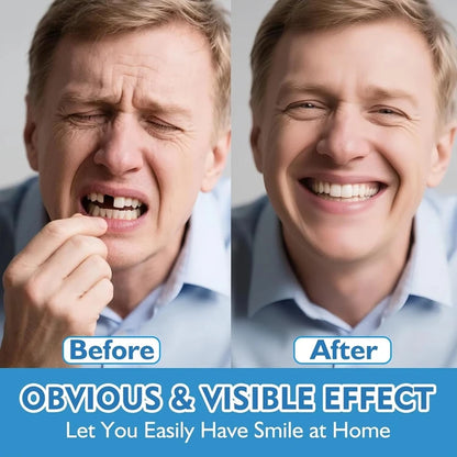 Comfort Fit Silicone Denture Set - Upper & Lower Instant Smile Veneers