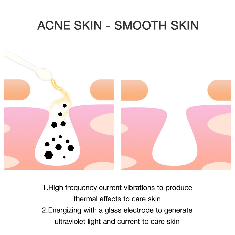4-in-1 High Frequency Facial Therapy Wand for Acne