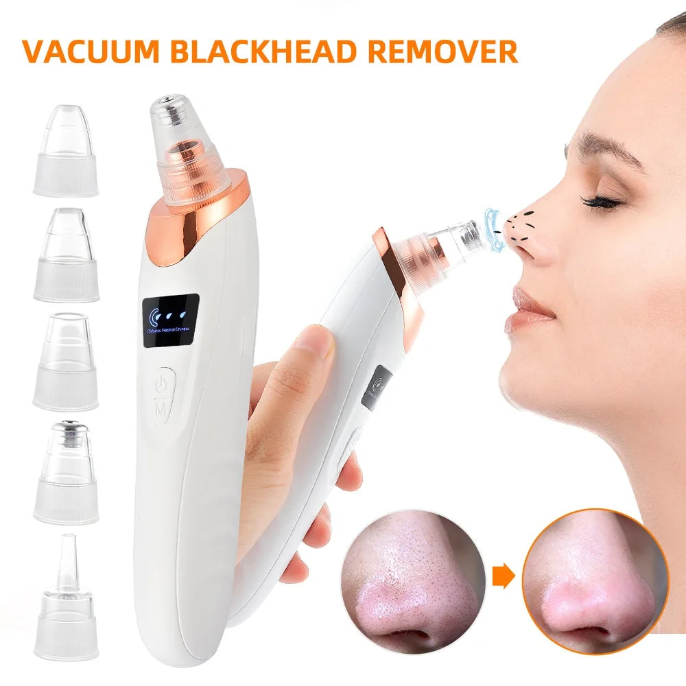 Electric Vacuum Blackhead Remover & Facial Pore Cleanser - 2